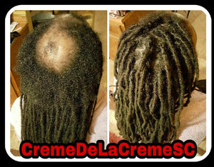 Dreadlock Hair Replacement System CONSULTATION FEE ONLY!