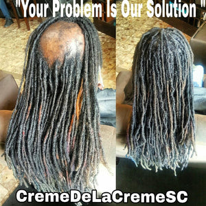 Dreadlock Hair Replacement System CONSULTATION FEE ONLY!